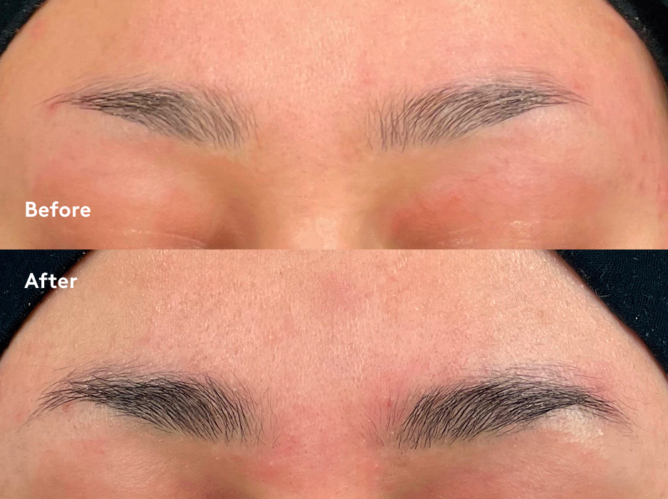Xbrow Sensitive Eyebrow Serum 3ml