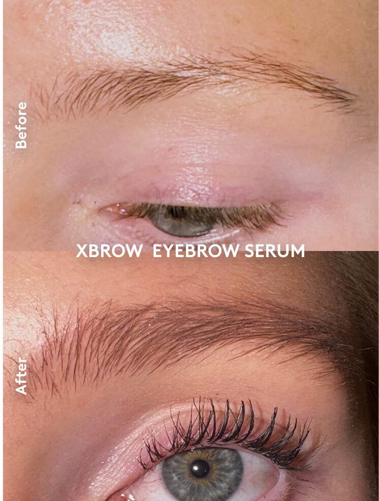 Xbrow Ögonbrynsserum 5ml
