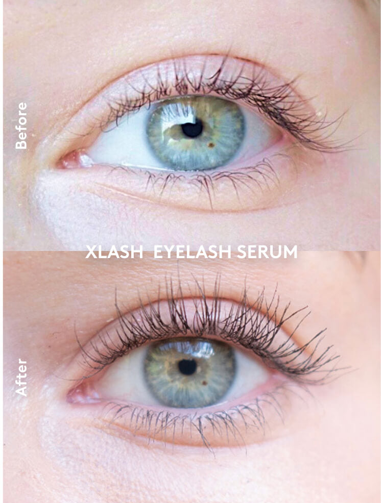 Xlash Ögonfransserum 1ml