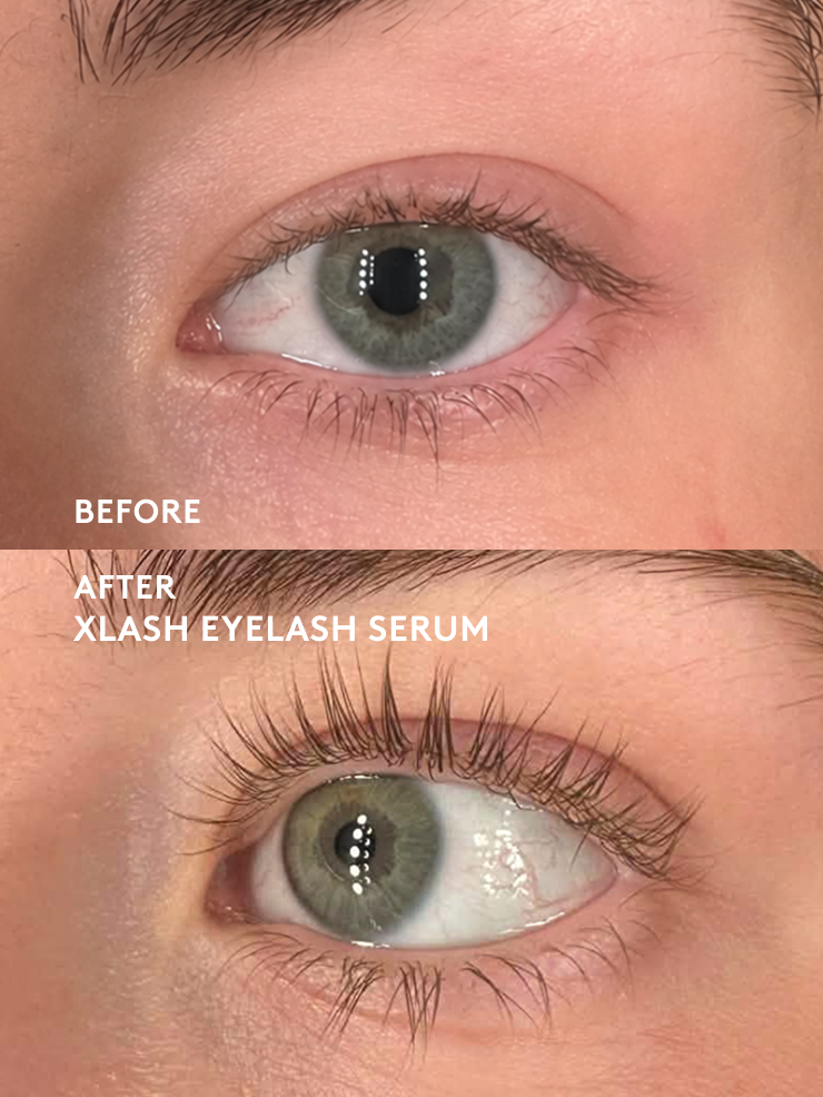 Xlash Ögonfransserum 5ml