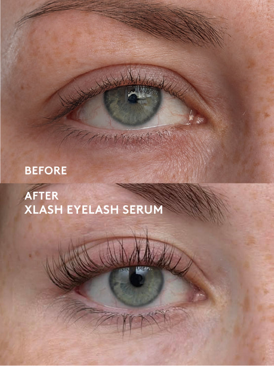 Grow & Boost Lash Kit Xlash 