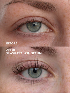 Grow & Boost Lash Kit Xlash 