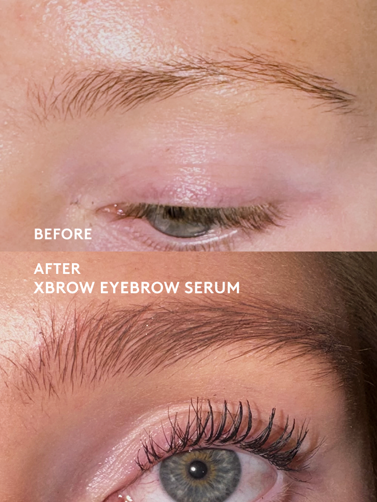 Xbrow Ögonbrynsserum 5ml