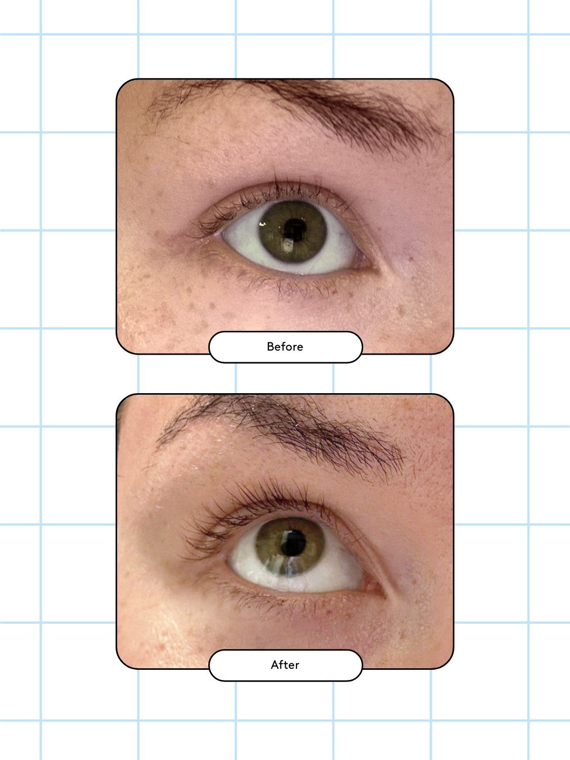 Xlash Ögonfransserum 5ml
