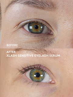 Xlash Sensitive Ögonfransserum 1ml