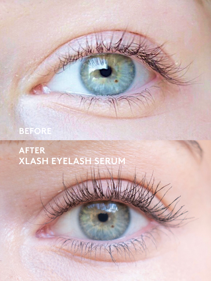 Xlash Eyelash Serum 1ml