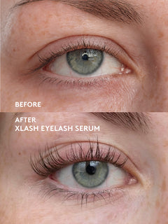 Xlash Ögonfransserum 3ml