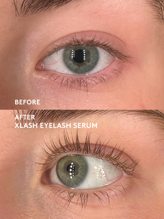 Xlash Ögonfransserum 5ml