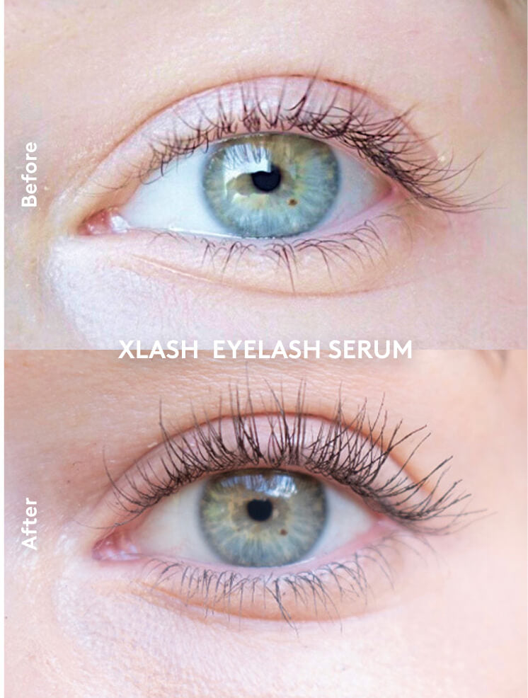 Xlash Ripsiseerumi 5ml