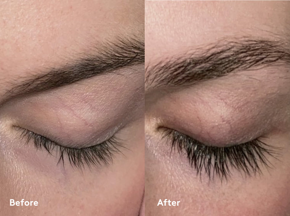 Xlash Ripsiseerumi 1ml