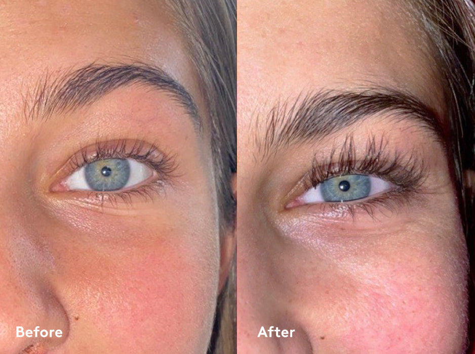 Xlash Ripsiseerumi 1ml